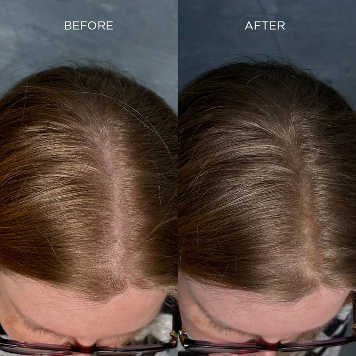 Fibra engrosadora de cabello Nanogen blanca