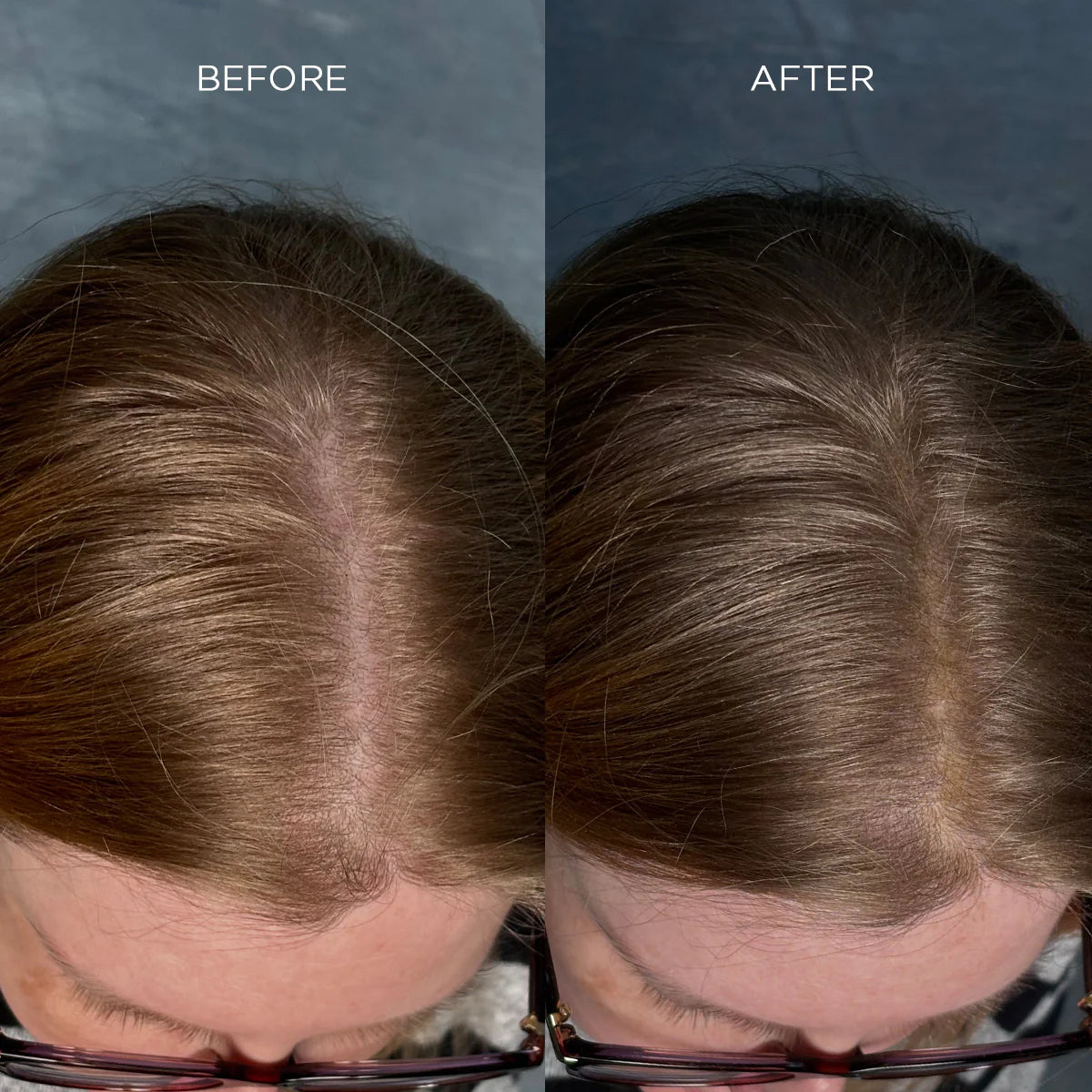 Fibra engrosadora de cabello Nanogen Canela