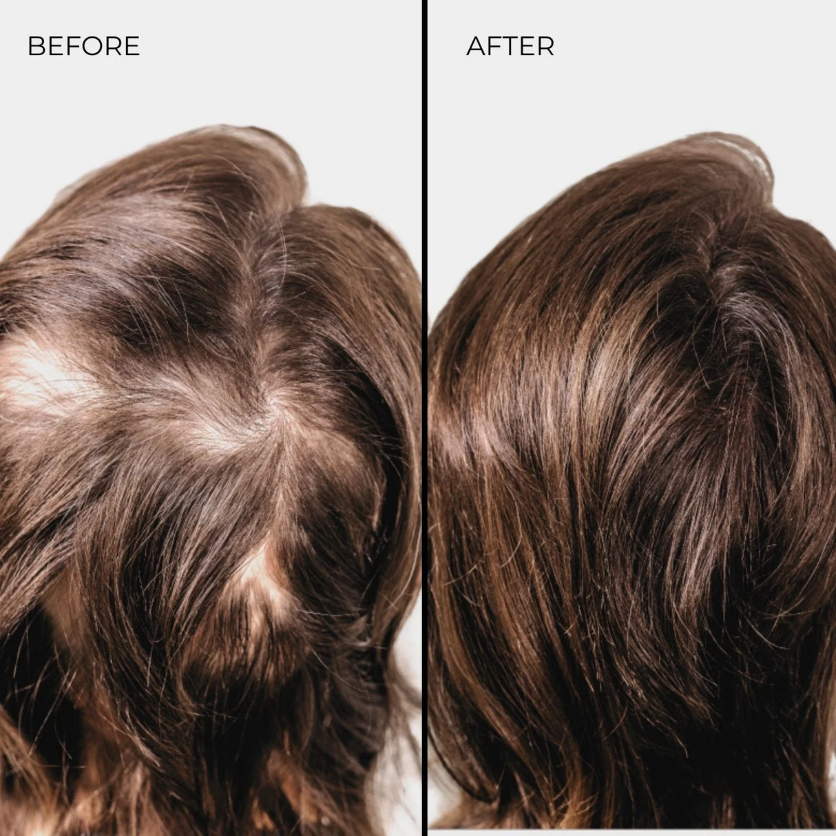 Fibra engrosadora de cabello Nanogen Canela