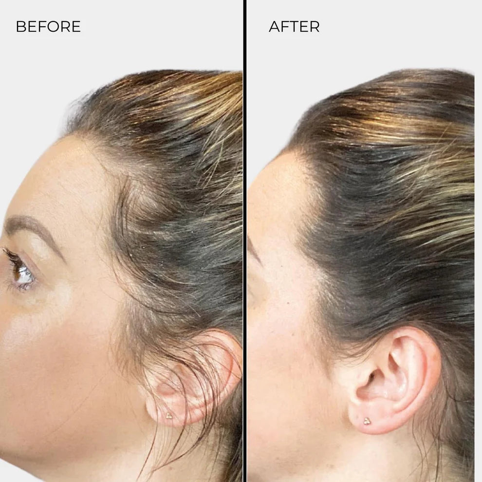 Fibras Engrosadoras para el Cabello Nanogen Rubio Oscuro