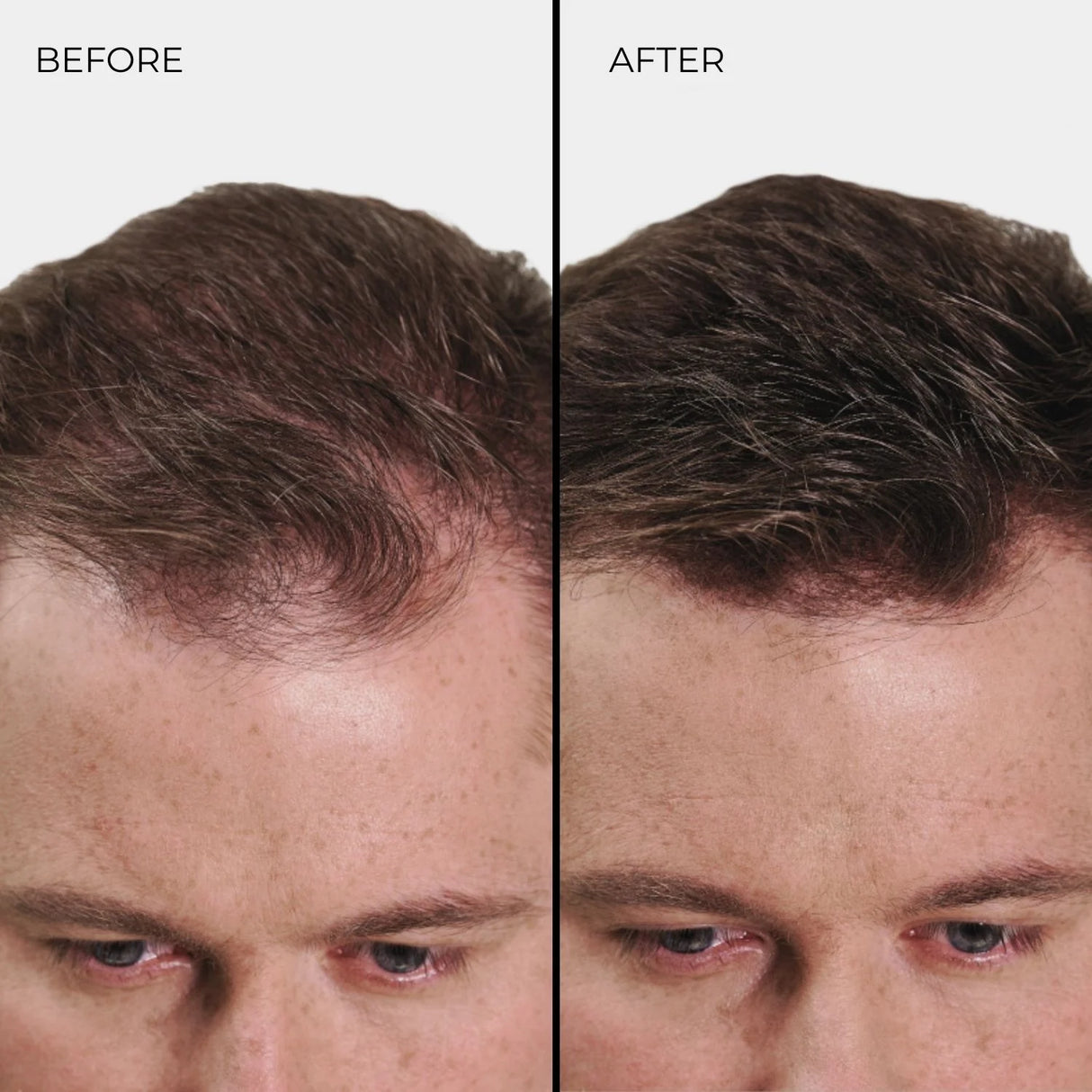 Fibra Engrosadora de Cabello Nanogen Rubio Claro