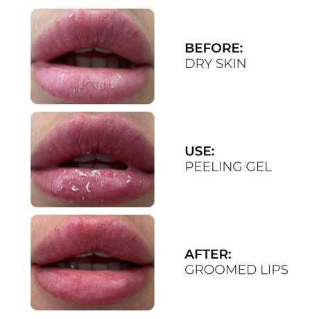 AS Company Peeling Gel (Active Oxygen) 17ml - BVShop