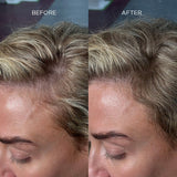 Fibra engrosadora de cabello Nanogen blanca