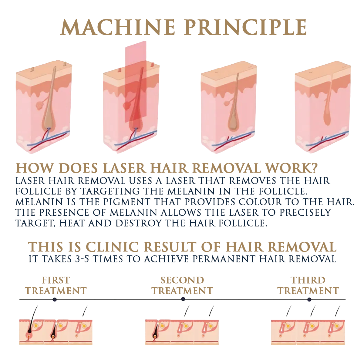 Rey de la Piel Qantum Pro Diodo y Láser de Picosegundos